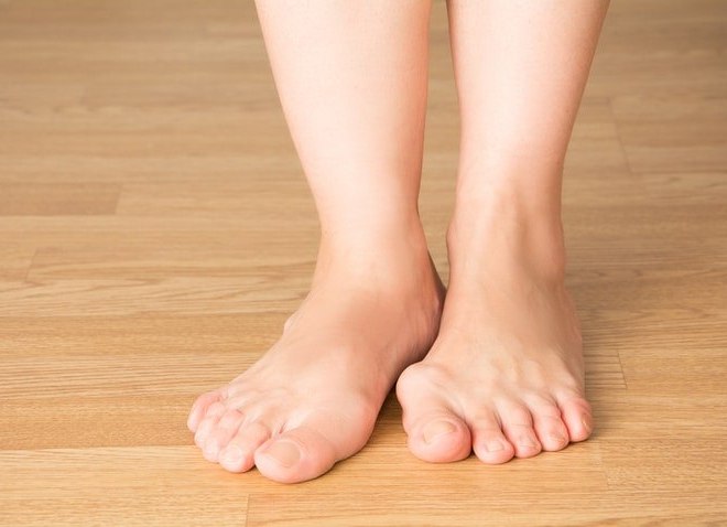 Bệnh gút là gì? Nguyên nhân, triệu chứng và cách chữa trị hiệu quả
